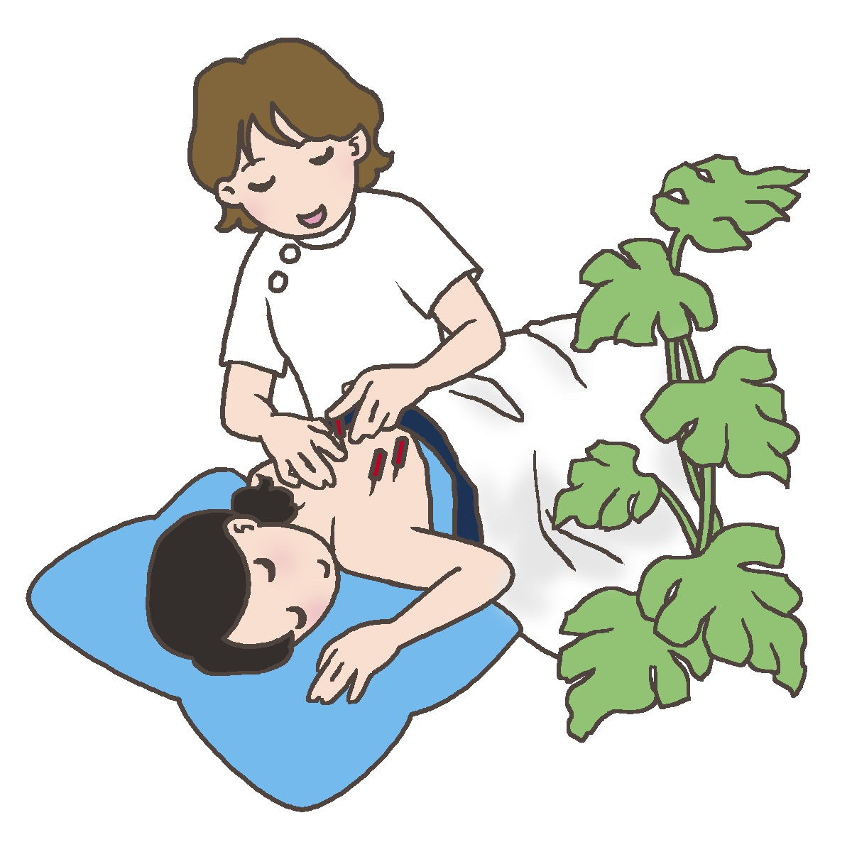 緑内障と鍼治療：伝統的アプローチで視力を守る可能性